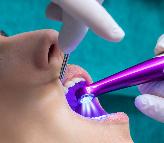 Applying dental sealants to patient's teeth