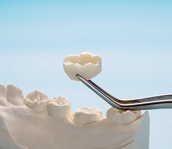 Lifting dental crown off model of tooth