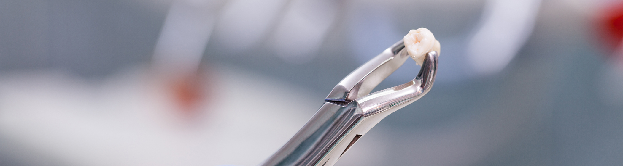 Forceps holding tooth after tooth extraction in Palm Coast